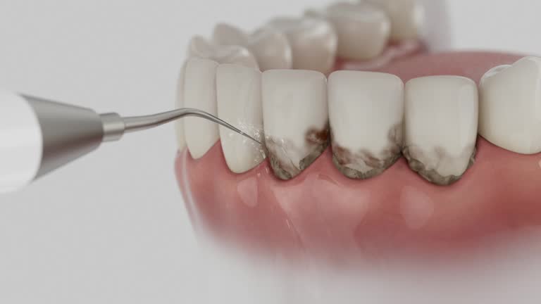 Trusted Root Canal Treatment service in Pleasant Valley, MO - Dentist Open Now
